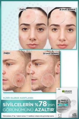 Garnier Pimple Patch 22'li Sivilce Bandı / Hidrokolloid Bant / Akne Karşıtı 22li Bant - 3