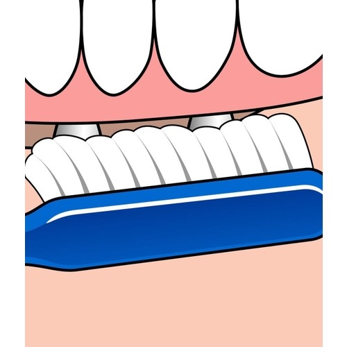 Tepe Diş Fırçası Implant Ortodontik - 3